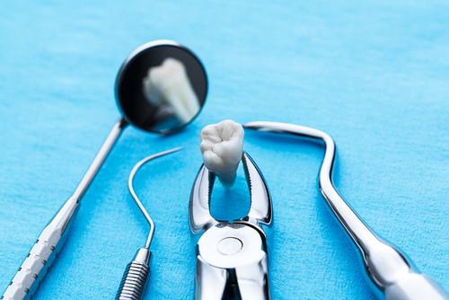 Tooth Extraction in Voorhees, NJ